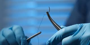Sutures & Staples